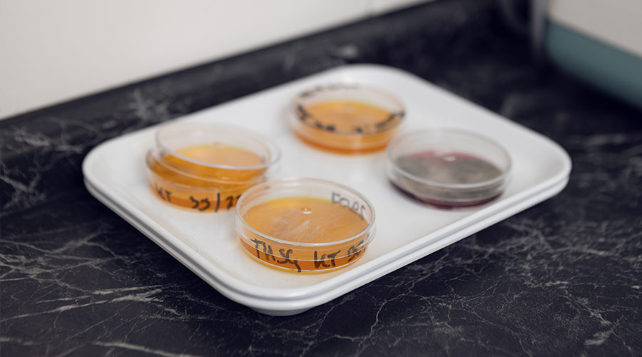 Vier beschriftete Petrischalen auf weißem Tablett, gefüllt mit gelblichem und rötlichem Nährboden, stehend auf schwarzer Oberfläche.